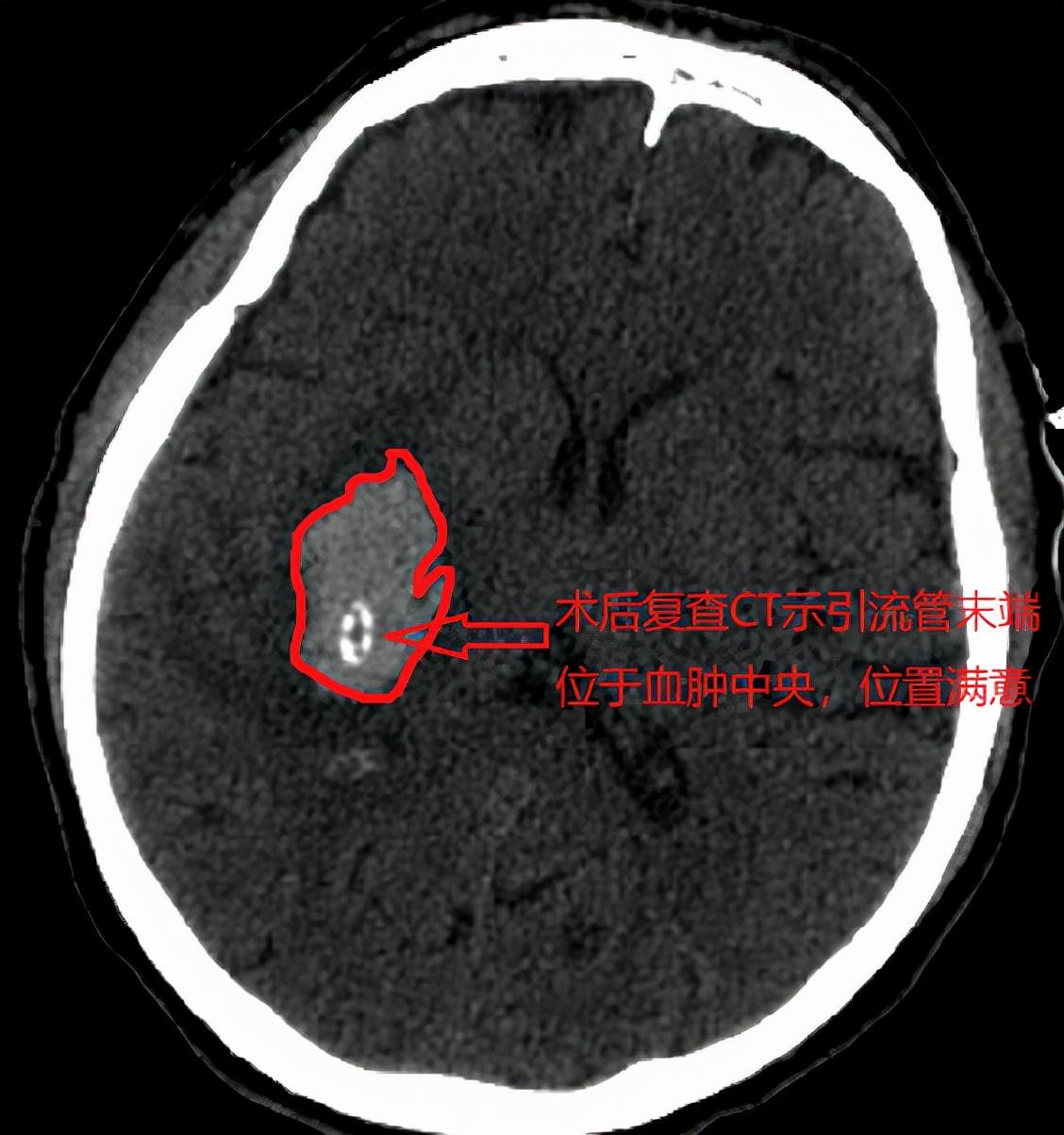 郴州二手房新篇章，家的温馨与友情的牵绊，最新房源信息汇总