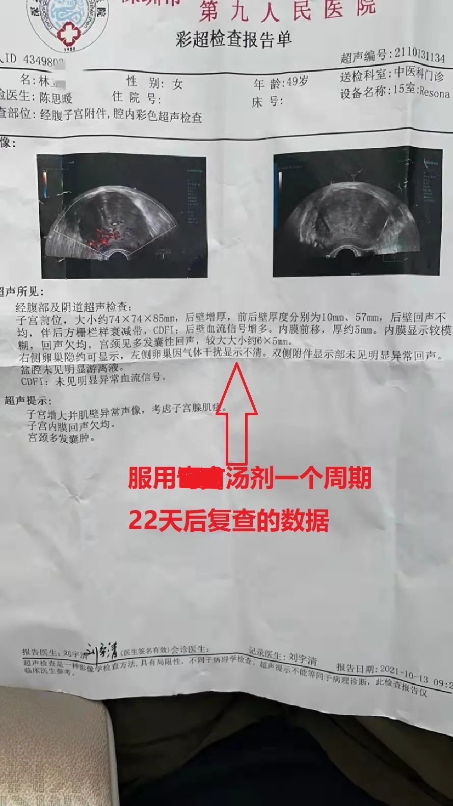 子宫腺肌症最新治疗奇遇记揭秘，探索最新治疗方法与经历分享