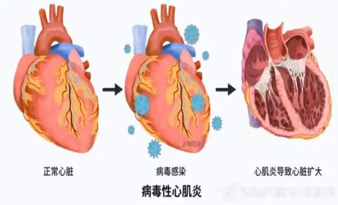 新冠最新症状表现概览📚