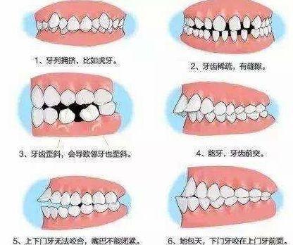 最新矫正牙齿全攻略，打造完美笑容的秘诀！